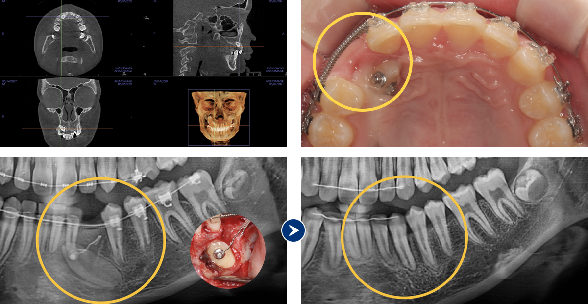 3D CT