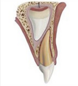 Subluxation
