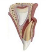 Lateral Luxation