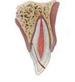 Enamel-dentin pulp fracture